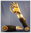 prosthetics above elbow