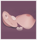 Cosmetic Restoration