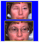 Cosmetic Restoration