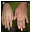 Cosmetic Restoration