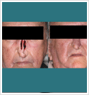 Cosmetic Restoration